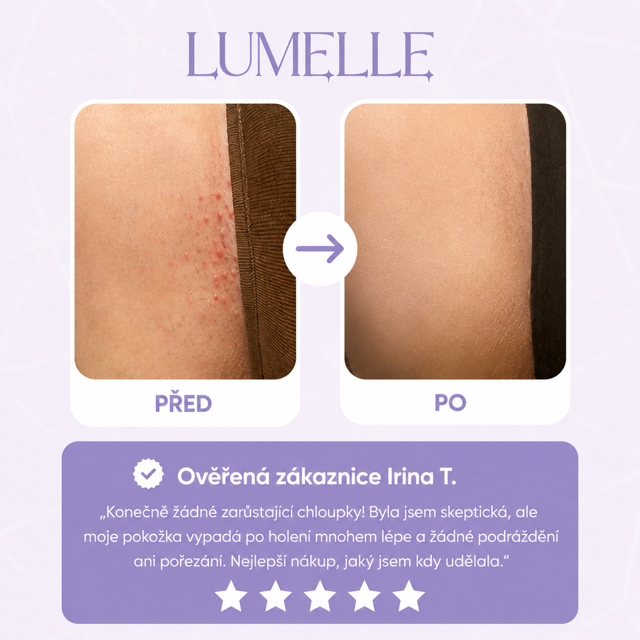 Lumelle: Trim & Smooth